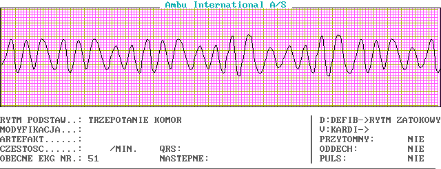EKG wykresy z łyżek, Pierwsza Pomoc - c51-0.png