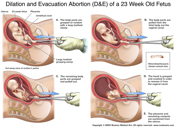 ABORCJI - STOP    NIE ZABIJAJ MNIE - d-e-23-weeks1.jpg